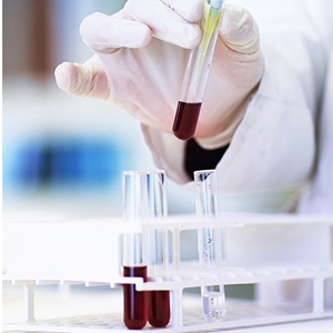 Plastic Test Tubes With Rack And Caps, 16 X 100mm With Holder For Scientific Experiments, Beads Liquid 2