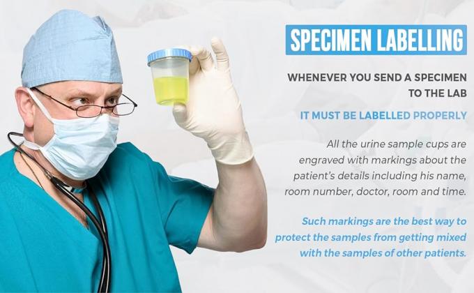 Supply Specimen Cups with Lids-Leak Proof Lid- High Quality Latex Free Polypropylene Plastic- Non-Sterile- 25 4oz 4