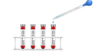 Glass Graduated Medicine Dropper Pipettes Lab Dropper With Blue Rubber Cap And Scale (3ml (2 Pack)) 2