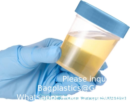 Specimen Cups With Leak Proof Screw On Lids - 4oz Clear Non-Sterile Urine Sample Jars - Containers